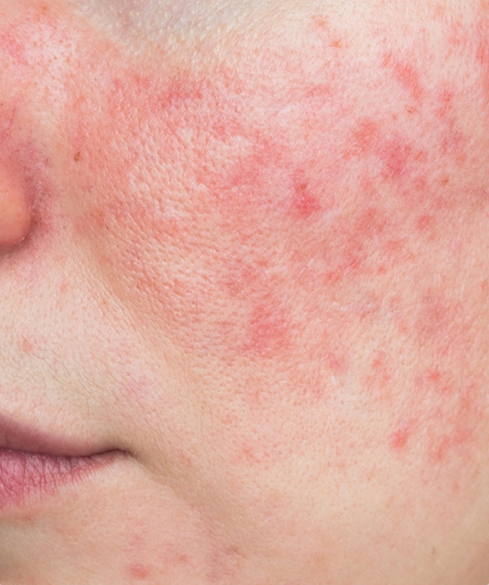 Dermatologia clínica e doenças de pele