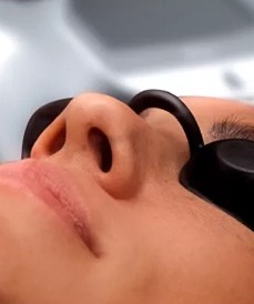 Procedimento com laser e ultrassom microfocado